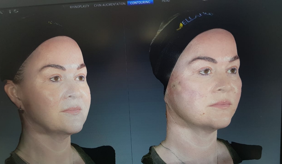 Soft Threading 3