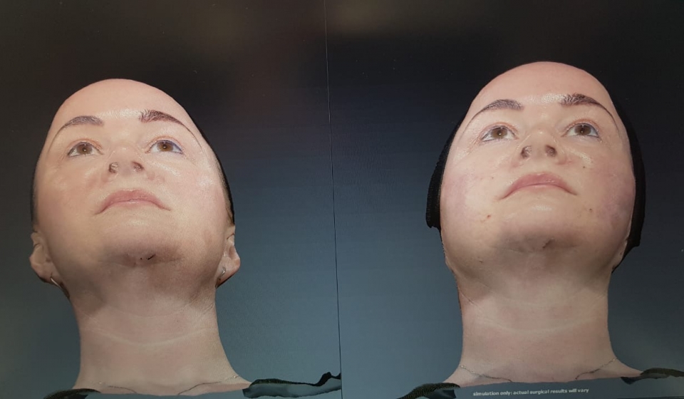 Soft Threading 4