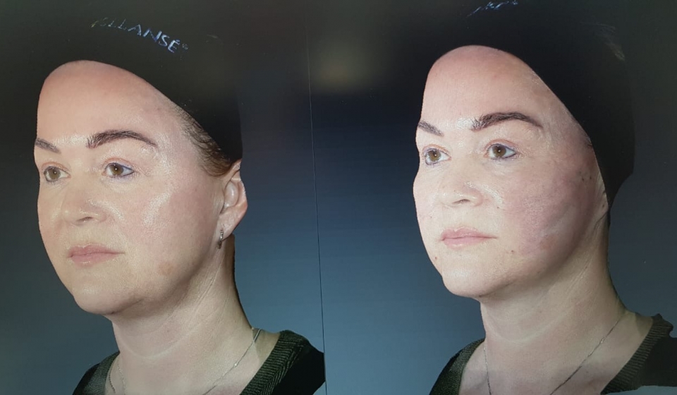 Soft Threading 6